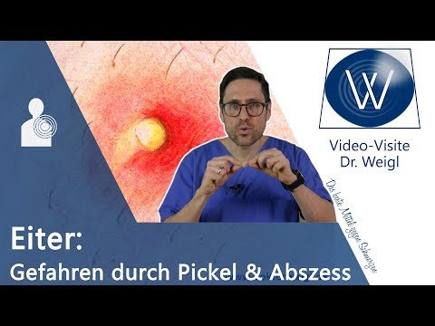 Doktorweigl Erklart Eiter Im Pickel Bei Abszessen Und In Wunden Ist Selbst Entfernen Eine Gute Idee Eiter Bei Abszessen Und In Wunden